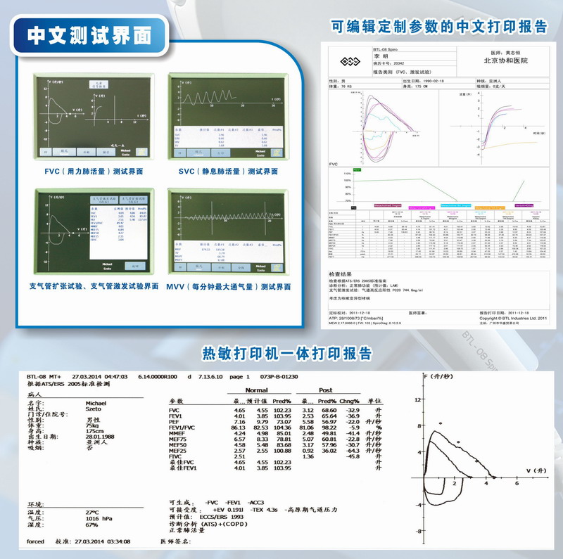 肺功能检查仪（便携式）