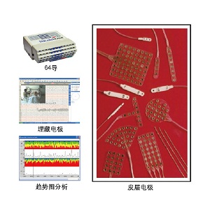 长程视频脑电图仪