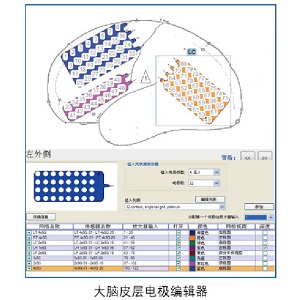 长程视频脑电图仪