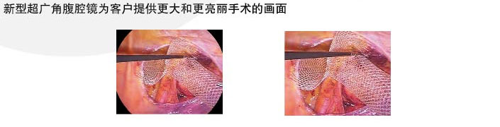 普外科电子腹腔镜系统