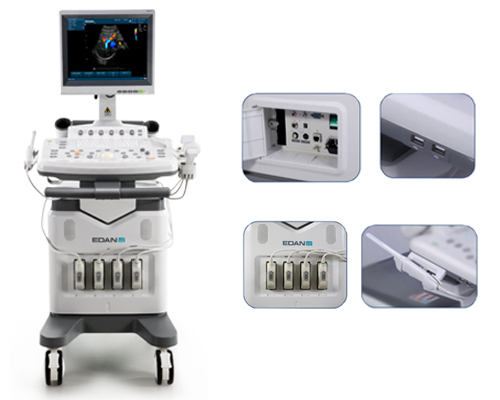 全数字彩色超声诊断系统