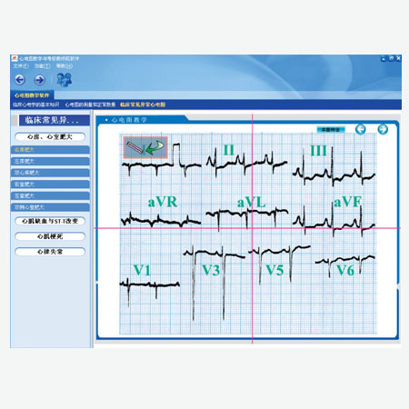 高智能数字网络化心电图模拟教学系统