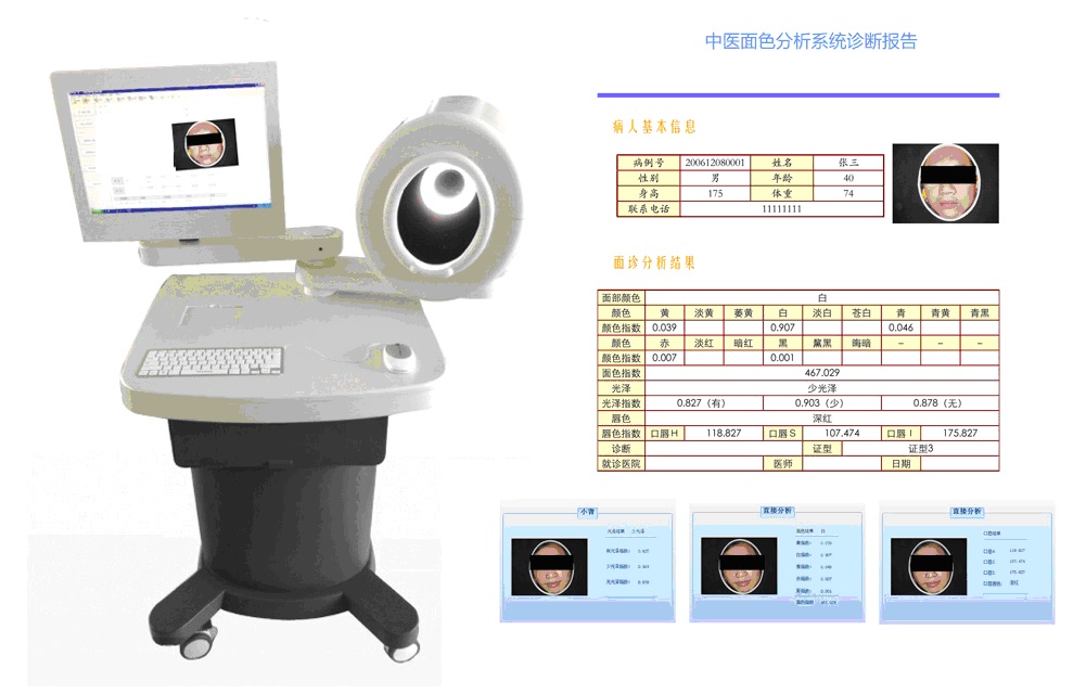 中医面诊检测分析系统（台车式）